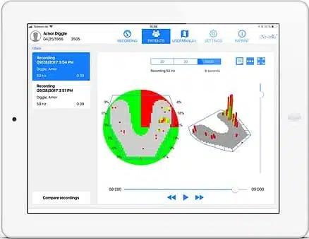 OccluSense by Bausch #5000M - Image 3